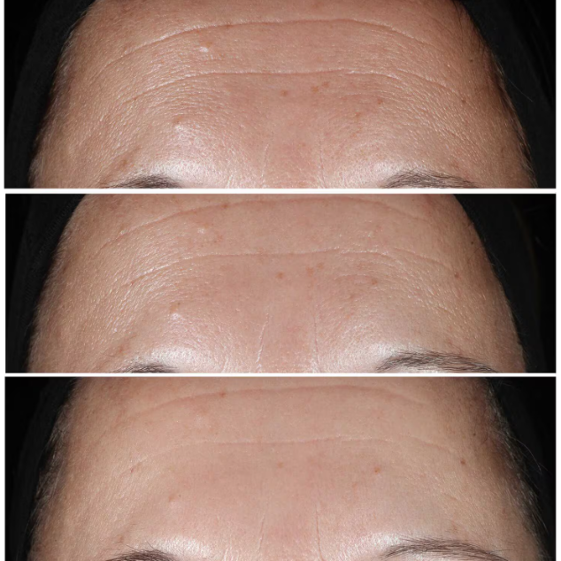 Sérum correcteur de rides Smart Clinical Repair